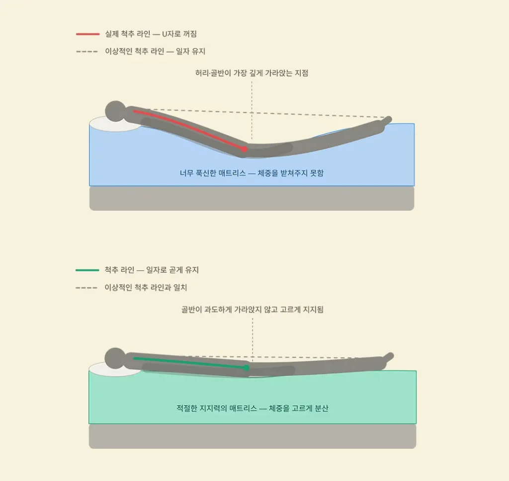 뼈 건강 침대 선택 시 중요한 매트리스 강도별 척추 정렬 비교
